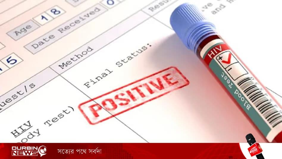 প্রথমবার দেহ থেকে সম্পূর্ণভাবে এইডস অপসরণ করল নোবেলজয়ী আবিষ্কার