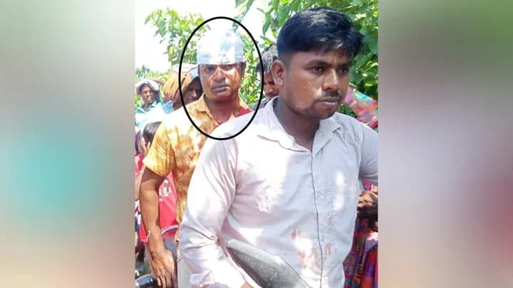 স্কুলের সামনেই শিক্ষককে দা দিয়ে কোপানোর অভিযোগ, গুরুতর জখম